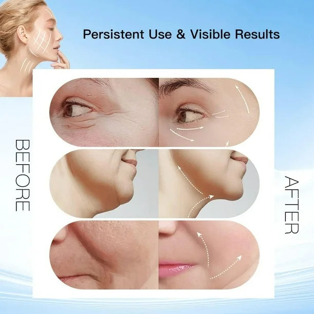 TONIFICADOR FACIAL ELECTRICO -  Eliminador Arrugas e imperfecciones 🌸✨